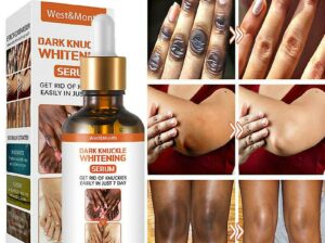 Dark Knuckle Whitening Serum Call +27710732372
