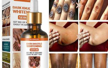 Dark Knuckle Whitening Serum Call +27710732372