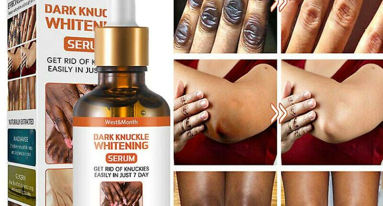 Dark Knuckle Whitening Serum Call +27710732372
