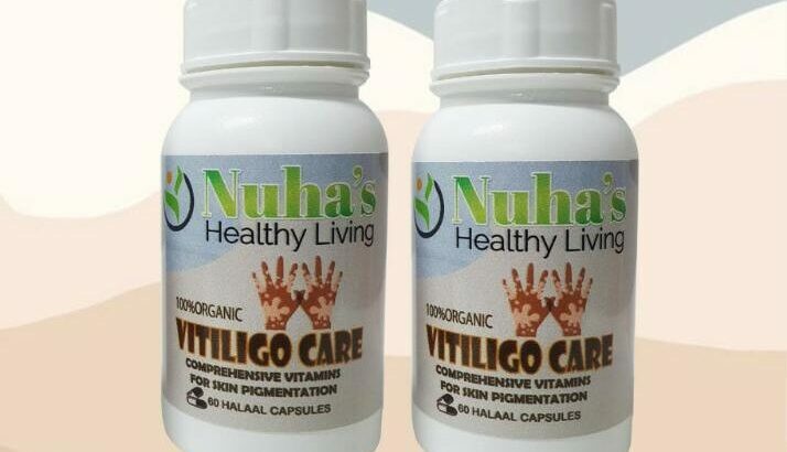 Get Rid Of Vitiligo In Pie Corner City In Barbados
