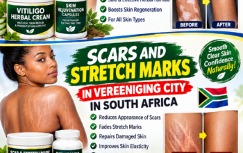 Get Rid Of Vitiligo In Pie Corner City In Barbados