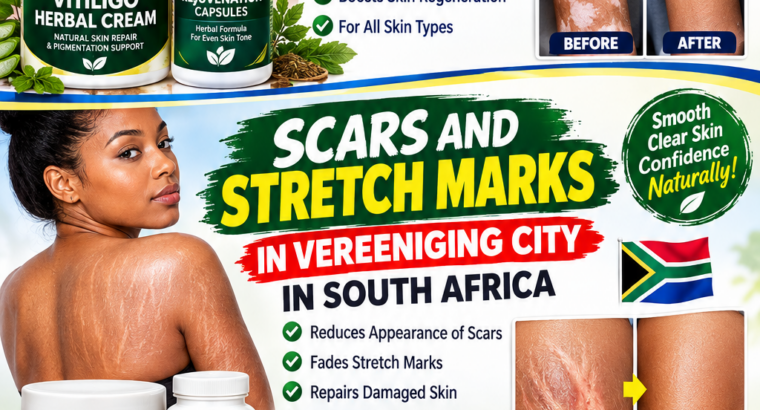 Get Rid Of Vitiligo In Pie Corner City In Barbados